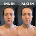 Vakna Piggare & Mindre Svullen på 2 Minuter